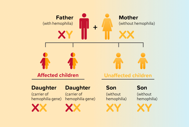 CHART OUTLINING HEREDITARY FACTORS OF WHY MALES ARE PRONE TO HEMOPHILIA